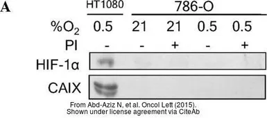 Anti-Carbonic Anhydrase IX antibody [GT12] used in Western Blot (WB). GTX70020