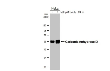 Anti-Carbonic Anhydrase IX antibody [GT12] used in Western Blot (WB). GTX70020