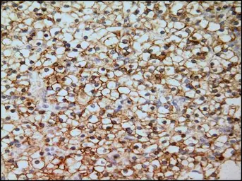 Anti-Carbonic Anhydrase IX antibody [GT12] used in IHC (Paraffin sections) (IHC-P). GTX70020