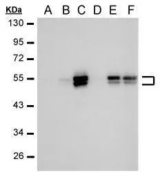 Anti-Carbonic Anhydrase IX antibody [GT12] used in Western Blot (WB). GTX70020