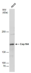 Anti-CEP164 antibody [13] used in Western Blot (WB). GTX70094