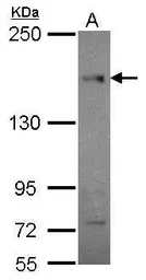 Anti-CEP164 antibody [13] used in Western Blot (WB). GTX70094