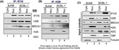 Anti-BRCA1 antibody [17F8] - ChIP grade used in Western Blot (WB). GTX70111