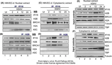 Anti-BRCA1 antibody [17F8] - ChIP grade used in Western Blot (WB). GTX70111