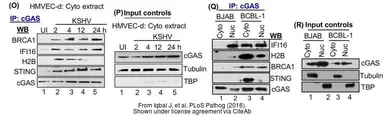 Anti-BRCA1 antibody [17F8] - ChIP grade used in Western Blot (WB). GTX70111