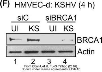 Anti-BRCA1 antibody [17F8] - ChIP grade used in Western Blot (WB). GTX70111