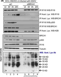 Anti-BRCA1 antibody [17F8] - ChIP grade used in Western Blot (WB). GTX70111