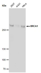 Anti-BRCA1 antibody [17F8] - ChIP grade used in Western Blot (WB). GTX70111