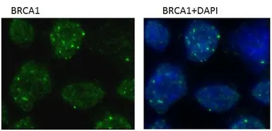 Anti-BRCA1 antibody [6B4] - ChIP grade used in Immunocytochemistry/ Immunofluorescence (ICC/IF). GTX70115