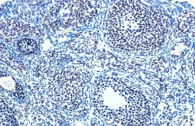 Anti-E2F1 antibody [18E10] used in IHC (Paraffin sections) (IHC-P). GTX70165