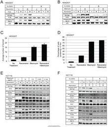 Anti-p53 antibody [DO1] used in Western Blot (WB). GTX70214