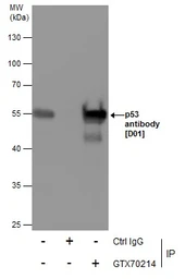 Anti-p53 antibody [DO1] used in Immunoprecipitation (IP). GTX70214