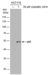 Anti-p53 antibody [DO1] used in Western Blot (WB). GTX70214