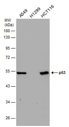 Anti-p53 antibody [DO1] used in Western Blot (WB). GTX70214