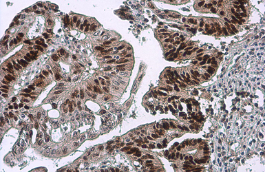 Anti-p53 antibody [DO1] used in IHC (Paraffin sections) (IHC-P). GTX70214