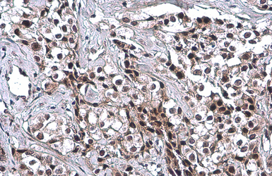 Anti-p53 antibody [DO1] used in IHC (Paraffin sections) (IHC-P). GTX70214