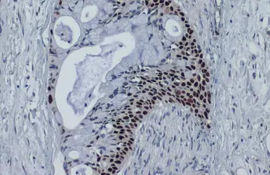 Anti-p53 antibody [DO1] used in IHC (Paraffin sections) (IHC-P). GTX70214