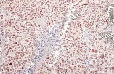 Anti-p53 antibody [DO1] used in IHC (Paraffin sections) (IHC-P). GTX70214