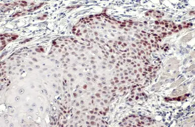 Anti-p53 antibody [DO1] used in IHC (Paraffin sections) (IHC-P). GTX70214