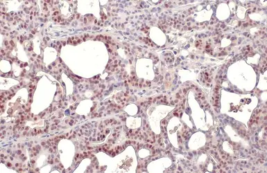 Anti-p53 antibody [DO1] used in IHC (Paraffin sections) (IHC-P). GTX70214