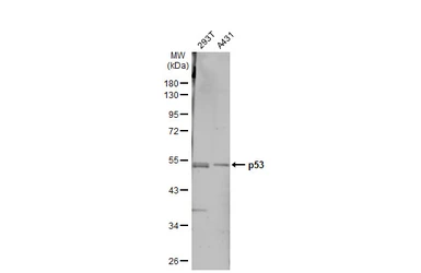 Anti-p53 antibody [Pab240] used in Western Blot (WB). GTX70218