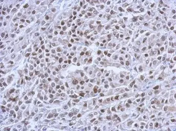 Anti-p53 antibody [Pab240] used in IHC (Paraffin sections) (IHC-P). GTX70218