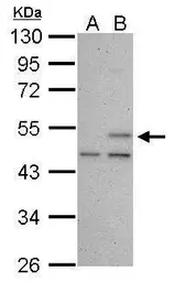 Anti-p53 antibody [Pab240] used in Western Blot (WB). GTX70218