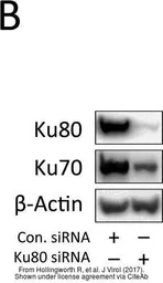 Anti-Ku80 antibody [149.8] used in Western Blot (WB). GTX70276