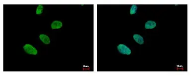 Anti-Ku80 antibody [149.8] used in Immunocytochemistry/ Immunofluorescence (ICC/IF). GTX70276