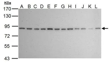 Anti-Ku80 antibody [149.8] used in Western Blot (WB). GTX70276