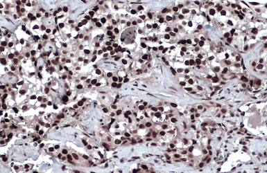 Anti-53BP1 antibody used in IHC (Paraffin sections) (IHC-P). GTX70310