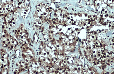 Anti-53BP1 antibody used in IHC (Paraffin sections) (IHC-P). GTX70310