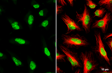 Anti-53BP1 antibody used in Immunocytochemistry/ Immunofluorescence (ICC/IF). GTX70310