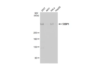 Anti-53BP1 antibody used in Western Blot (WB). GTX70310