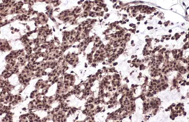 Anti-53BP1 antibody used in IHC (Paraffin sections) (IHC-P). GTX70310