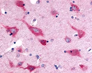 Anti-Hepatitis C virus antibody used in Immunohistochemistry (IHC). GTX70331