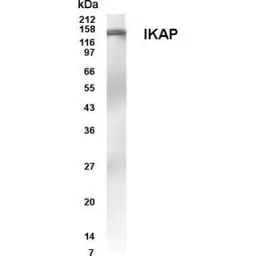 Anti-IKAP antibody used in Western Blot (WB). GTX70364