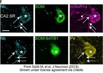 Anti-Somatostatin antibody [SOM-018] used in IHC (Frozen sections) (IHC-Fr). GTX71935