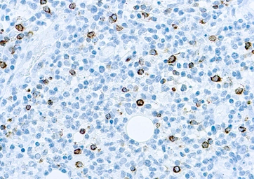 Anti-EBV antibody [CS1, CS2, CS3, CS4] (ready-to-use) used in IHC (Paraffin sections) (IHC-P). GTX73439