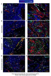 Anti-CD68 antibody [PG-M1] used in Immunohistochemistry (IHC). GTX73723