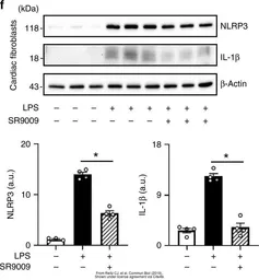 Anti-IL1 beta antibody used in Western Blot (WB). GTX74034