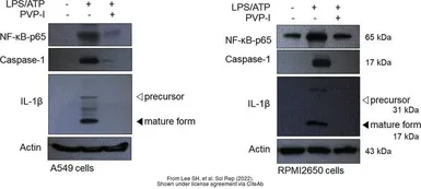 Anti-IL1 beta antibody used in Western Blot (WB). GTX74034