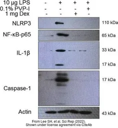 Anti-IL1 beta antibody used in Western Blot (WB). GTX74034