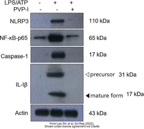 Anti-IL1 beta antibody used in Western Blot (WB). GTX74034