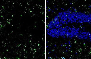 Anti-IL1 beta antibody used in IHC (Frozen sections) (IHC-Fr). GTX74034