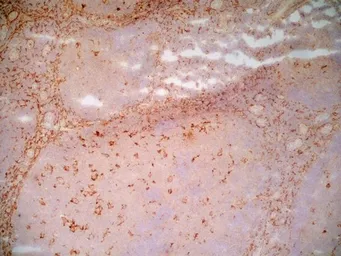 Anti-LRP1 antibody [A2Mr alpha-2] used in IHC (Frozen sections) (IHC-Fr). GTX75655