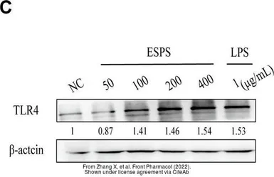 Anti-TLR4 antibody [HTA125] used in Western Blot (WB). GTX75742