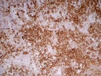 Anti-CD11b antibody [OX-42] used in IHC (Frozen sections) (IHC-Fr). GTX76060