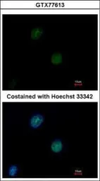 Anti-ATM antibody [2C1] (supernatant) used in Immunocytochemistry/ Immunofluorescence (ICC/IF). GTX77613