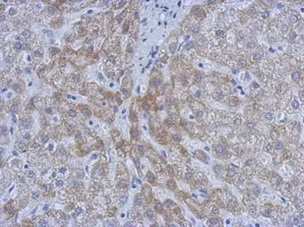 Anti-ATM antibody [2C1] (supernatant) used in IHC (Paraffin sections) (IHC-P). GTX77613